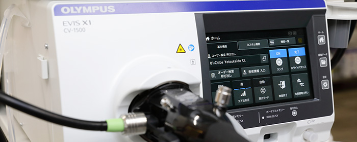 高性能な内視鏡システムの導入で微細な病変も発見
